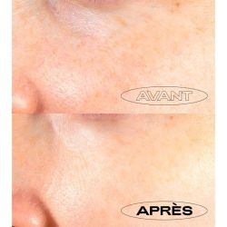 Fluide Anti-Taches Haute Protection SPF30 - 40 ml