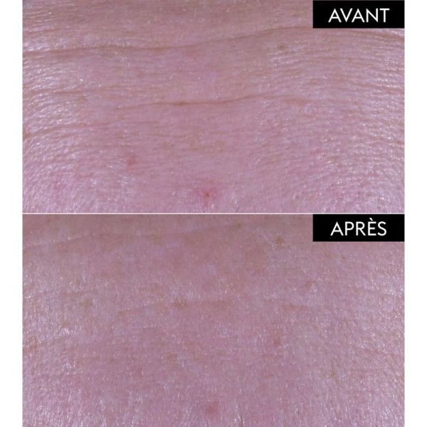 Patyka Serum Repulpant Fondamental 30 Ml