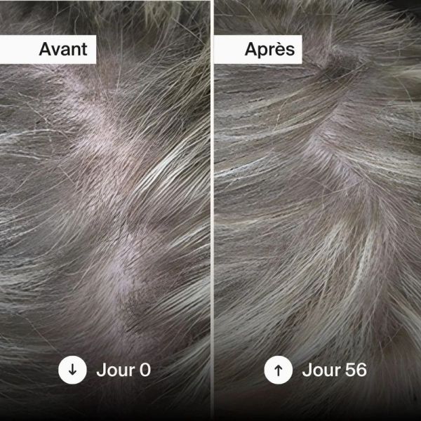 Gummies Cheveux
