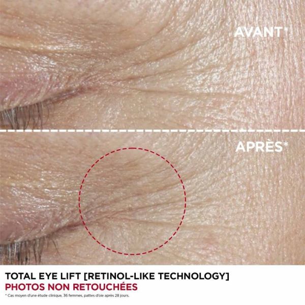 Total Eye Lift Rechargeable - Pot 15 ml