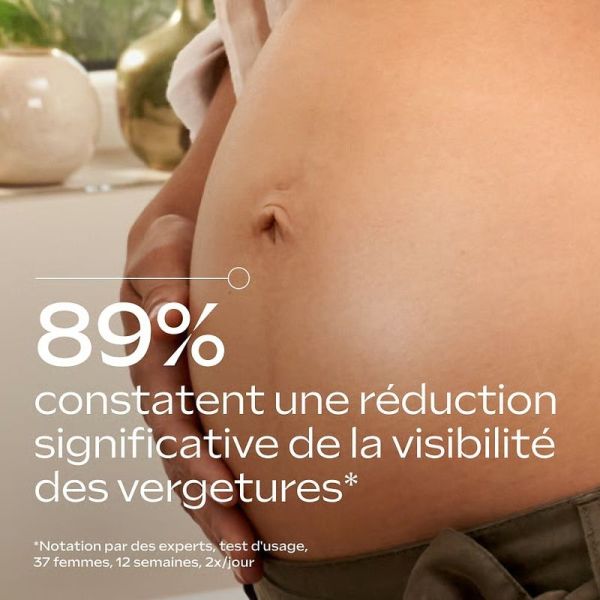 Baume de Massage Vergetures - 150 ml