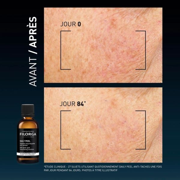 DAILY PEEL - 50 ml
