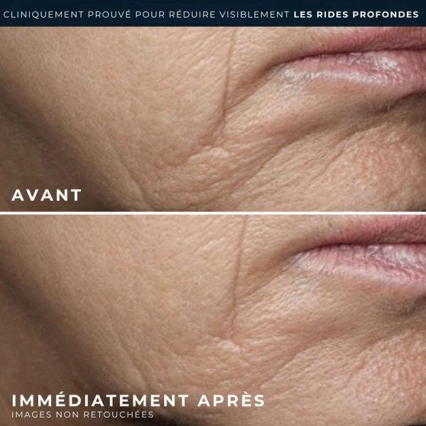 RETINOL CORREXION Rides profondes Crème Riche
