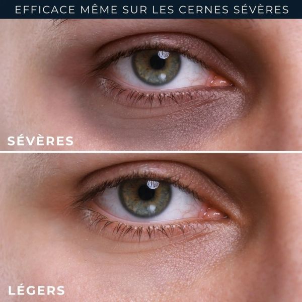 Soin Correcteur Cernes Eye Repair DERM CORREXION - 15 ml