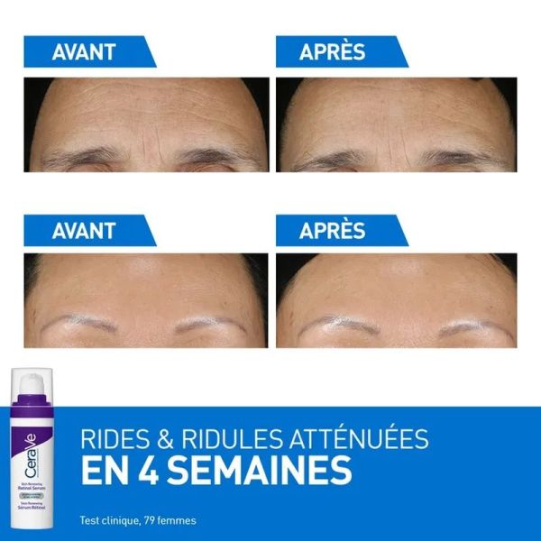 Skin Renewing Serum Retinol - 30 ml