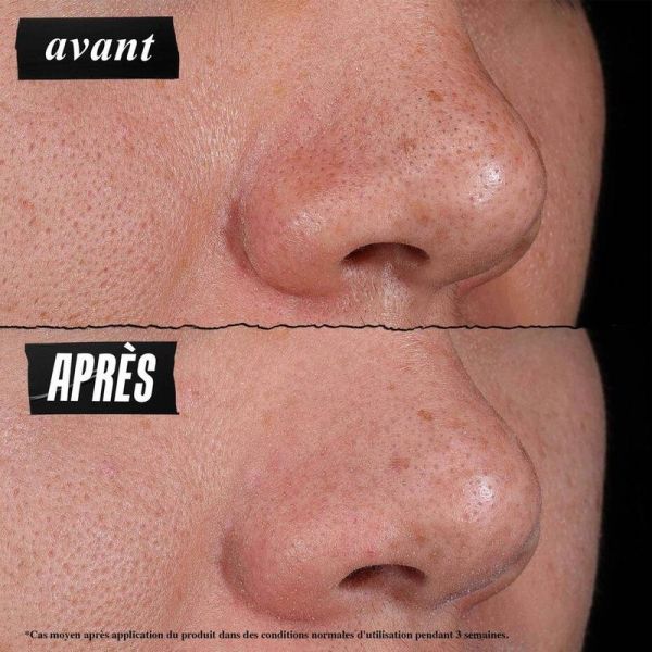 Rare Earth Deep Pore Cleansing Mask - 125 ml