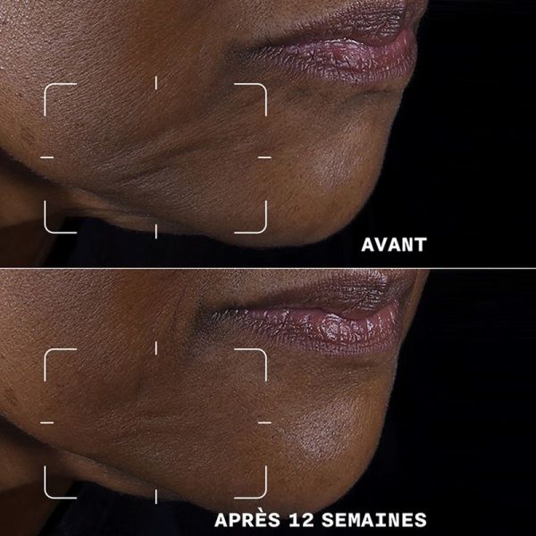 Crème Liftante Visage + Cou Smart Clinical Repair - 50 ml