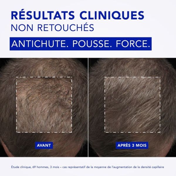Traitement Antichute Progressive Phytocyane Intensive+ - Homme - 12 x 5 ml