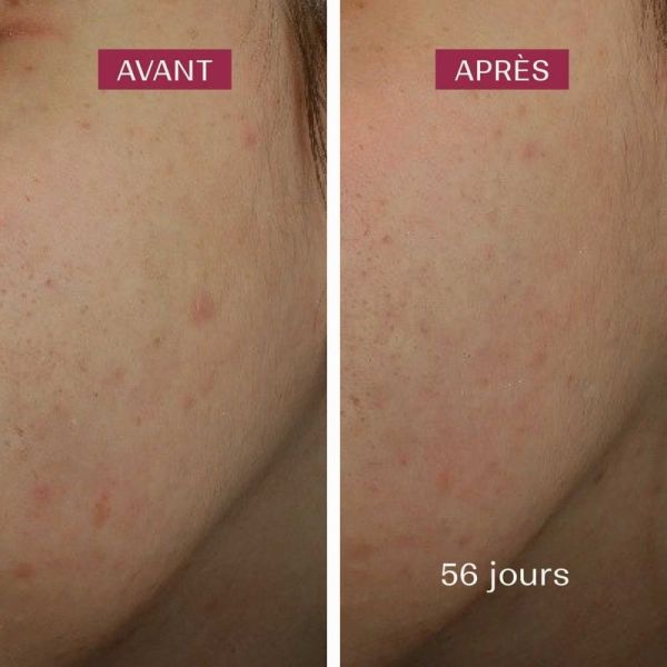Sérum anti-taches - 30 ml