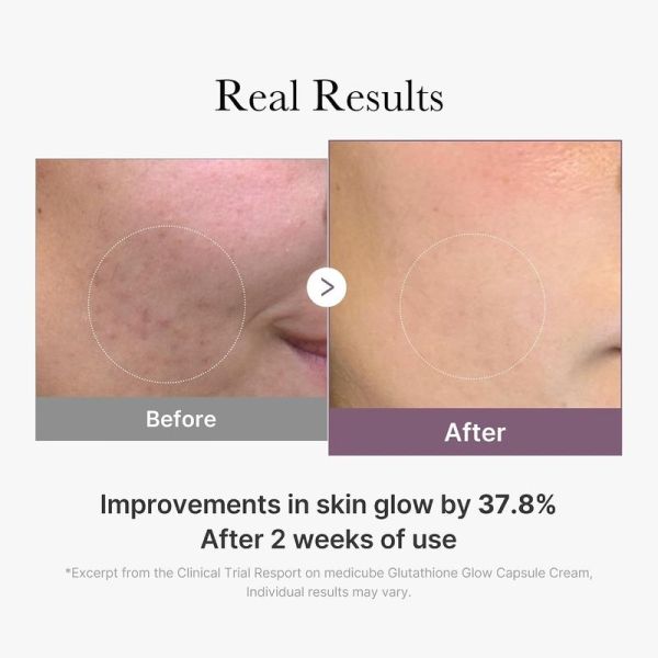 AGE-R Glutathione Glow Capsule Cream - 50 ml