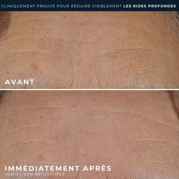 RETINOL CORREXION Rides profondes Crème Riche