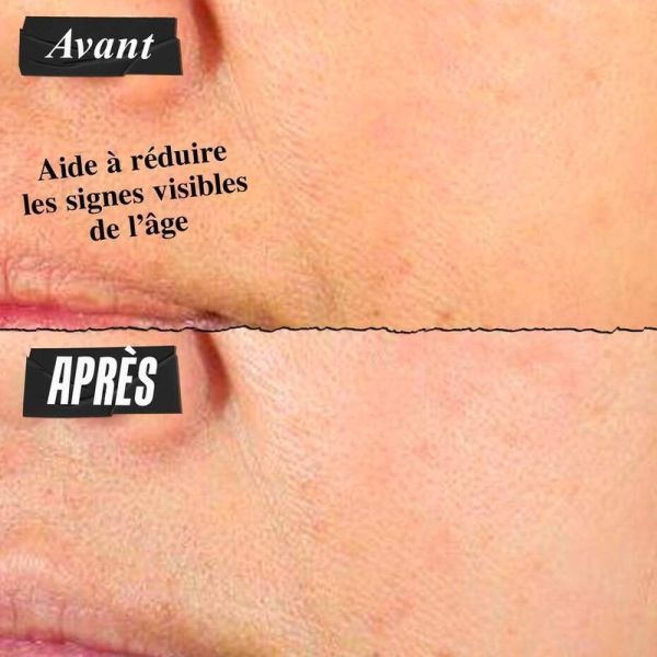 Super Multi-Corrective Cream - 50 ml