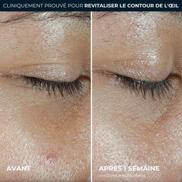 Renouveau + Eclat Baume pour les yeux MULTI CORREXION
