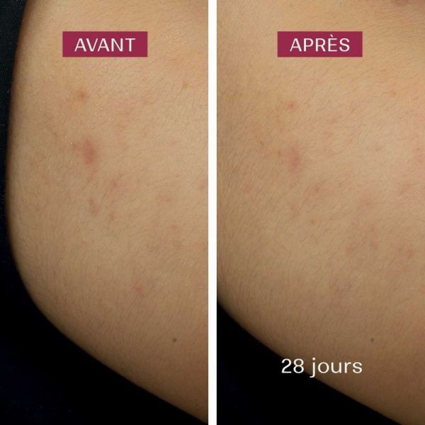 Crème de nuit anti-taches - 50 ml
