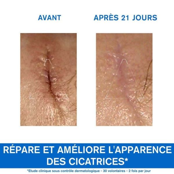 Crème Réparatrice Marques Cicatricielles Bariederm CICA+ - 100 ml