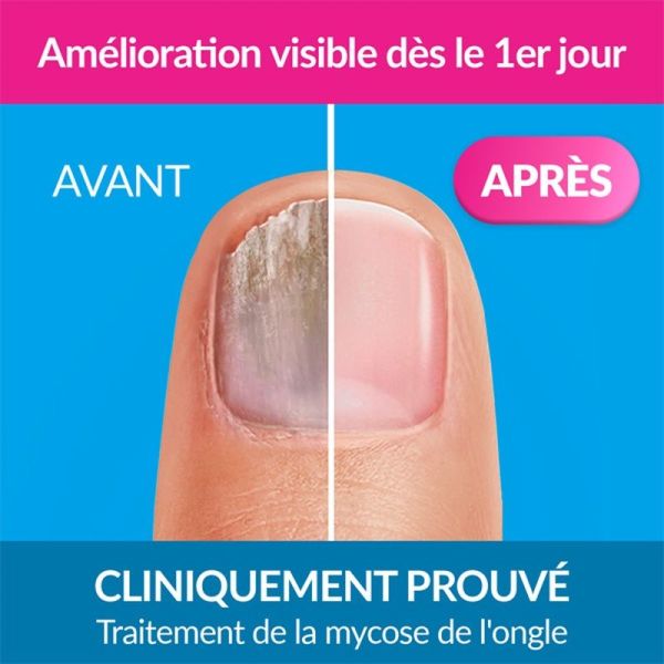 Solution filmogène Excilor Forte - 30 ml + coupe-ongles offert