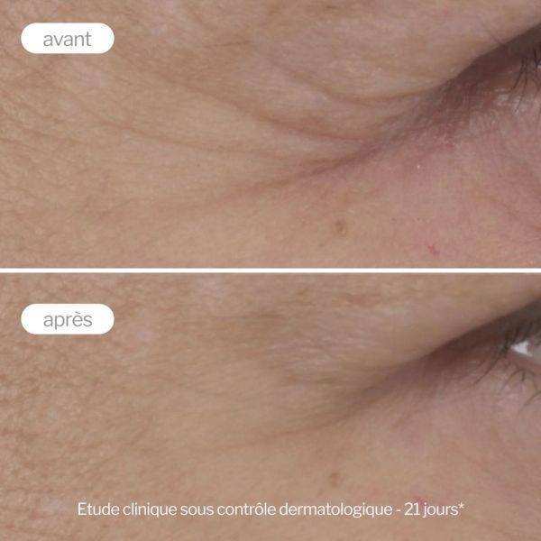 Contour des Yeux Anti-Âge Expert - 15 ml