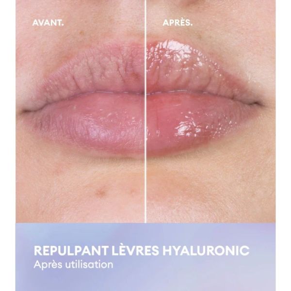 Repulpant Lèvres Hyaluronic - 7 ml