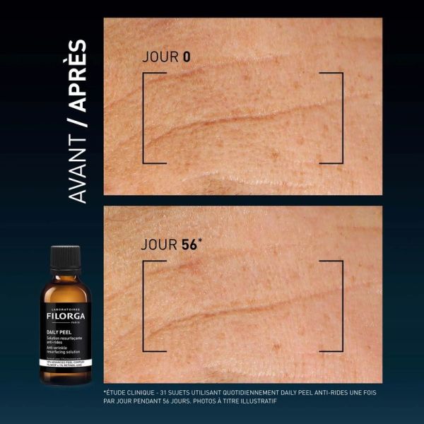 DAILY PEEL Anti-rides - 50 ml