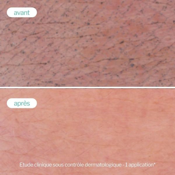Gelée Moussante Peau Nette - 150 g