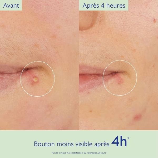 Stop Boutons Salicylique Vinopure - 15 ml