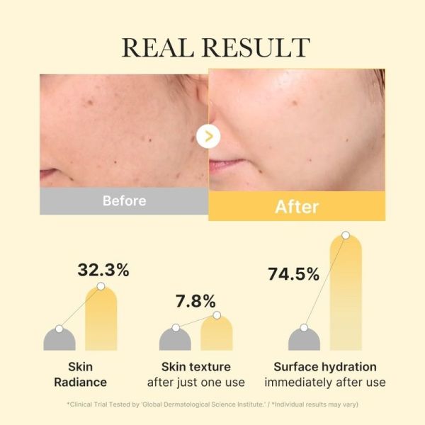 Kojic Acid Turmeric Gold Jelly Gel Mask - 28 g
