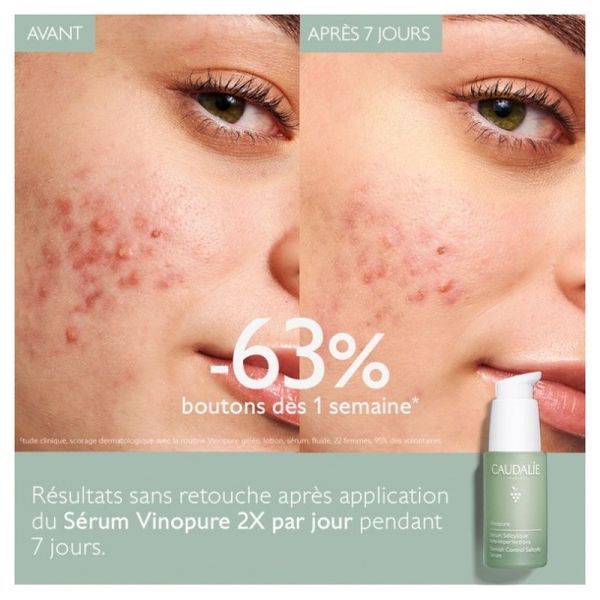 Sérum à l'Acide Salicylique Anti-imperfections Vinopure - 30 ml