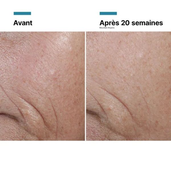 A.G.E. Interrupter Ultra Serum - 30 ml