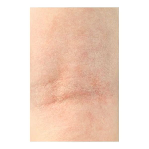 Crème sécheresse cutanée - 500 g