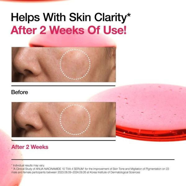 Niacinamide 10% + TXA 4% Serum - 30 ml