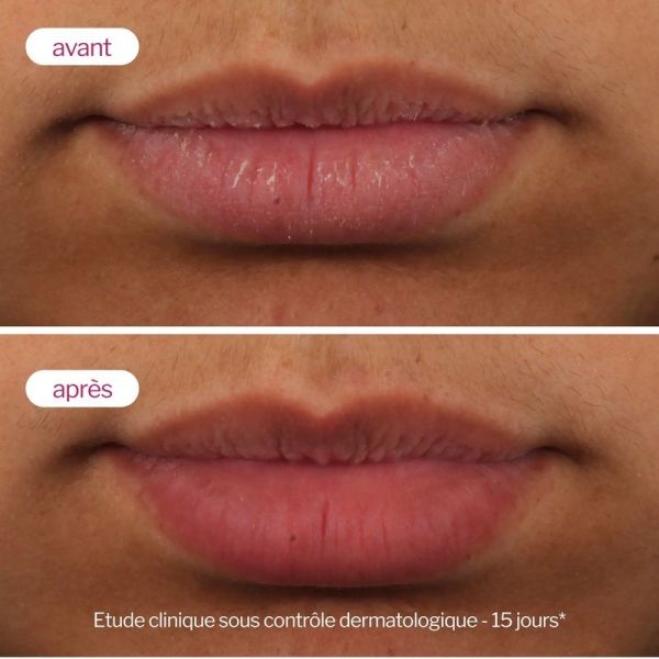 Lip'Up - 8 ml