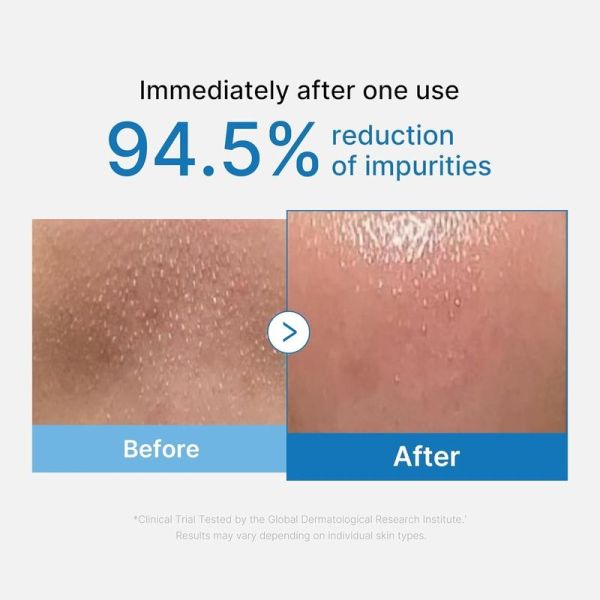 Zero Pore Huile Nettoyante Intense - 205 ml