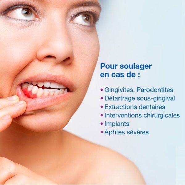 Hyalugel Forte Perio Gel Assainissant - 8 ml