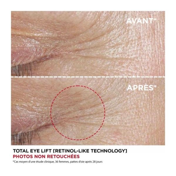 Total Eye Lift Rechargeable - Recharge 15 ml