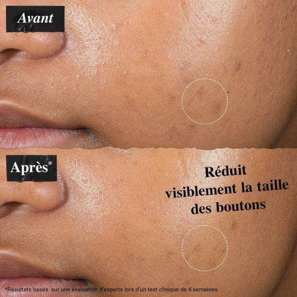Patch Liquide Invisible Anti-Imperfections - 15 ml