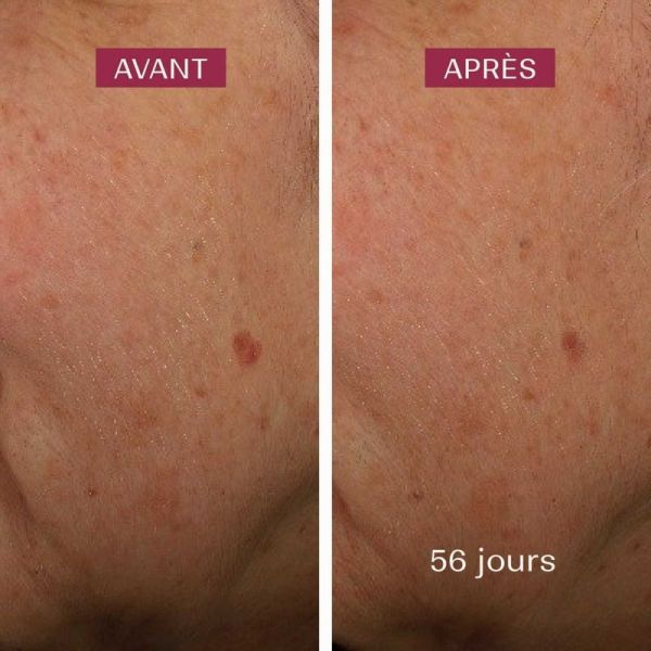 Sérum anti-taches - 30 ml