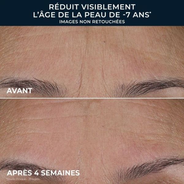 Soin Lissant Triple Sérum Retinol Correxion - 30 ml