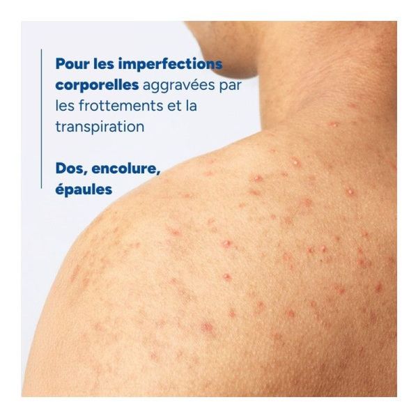 Keracnyl Spray corps asséchant anti-boutons - 150 ml