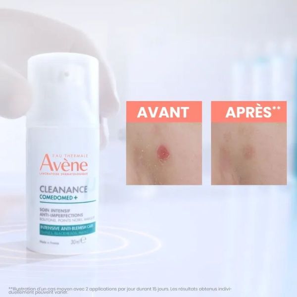Comedomed+ Soin Intensif Anti-Imperfections Cleanance - 30 ml