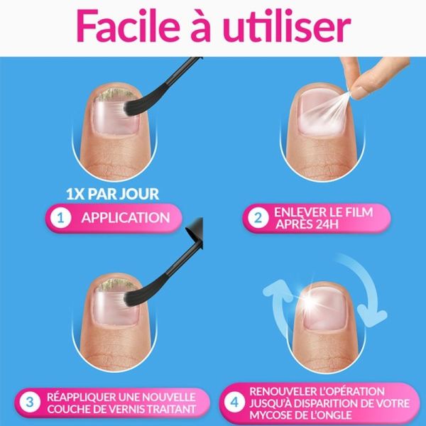 Solution filmogène Excilor Forte - 30 ml + coupe-ongles offert