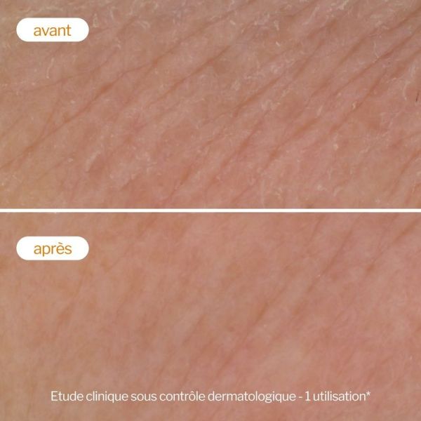 Mousse Nettoyante Flash Éclat - 150 ml
