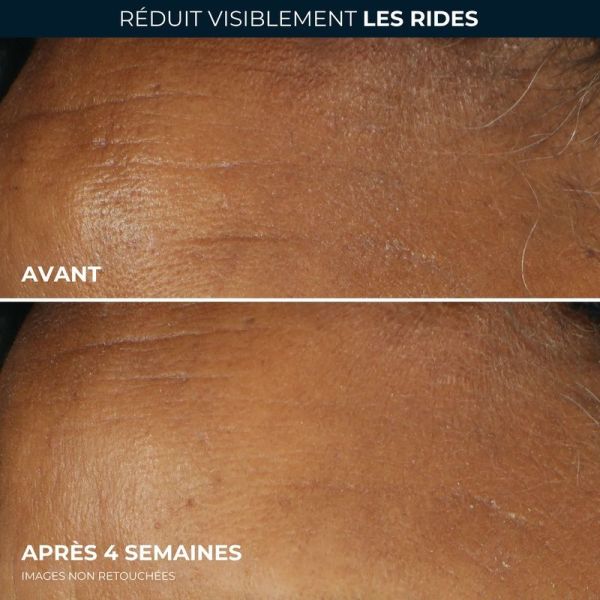 Correction Rides Hydratant Quotidien SPF30 RETINOL CORREXION