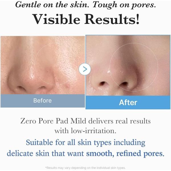 Zero Pore Pad Mild 2.0 - 70 disques imprégnés
