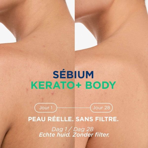 Sébium Kerato+ Body - 150 ml