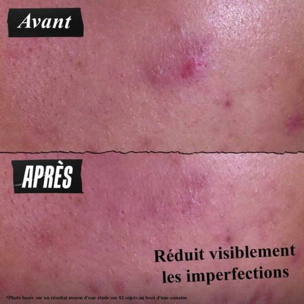 Pâte Nettoyante Anti-Imperfections - 125 ml
